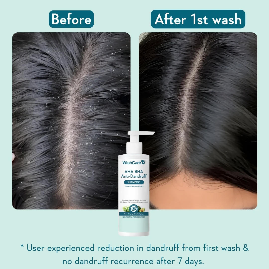 AHA BHA Anti-Dandruff Shampoo - Image 3